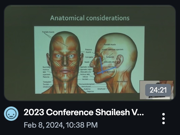 v20